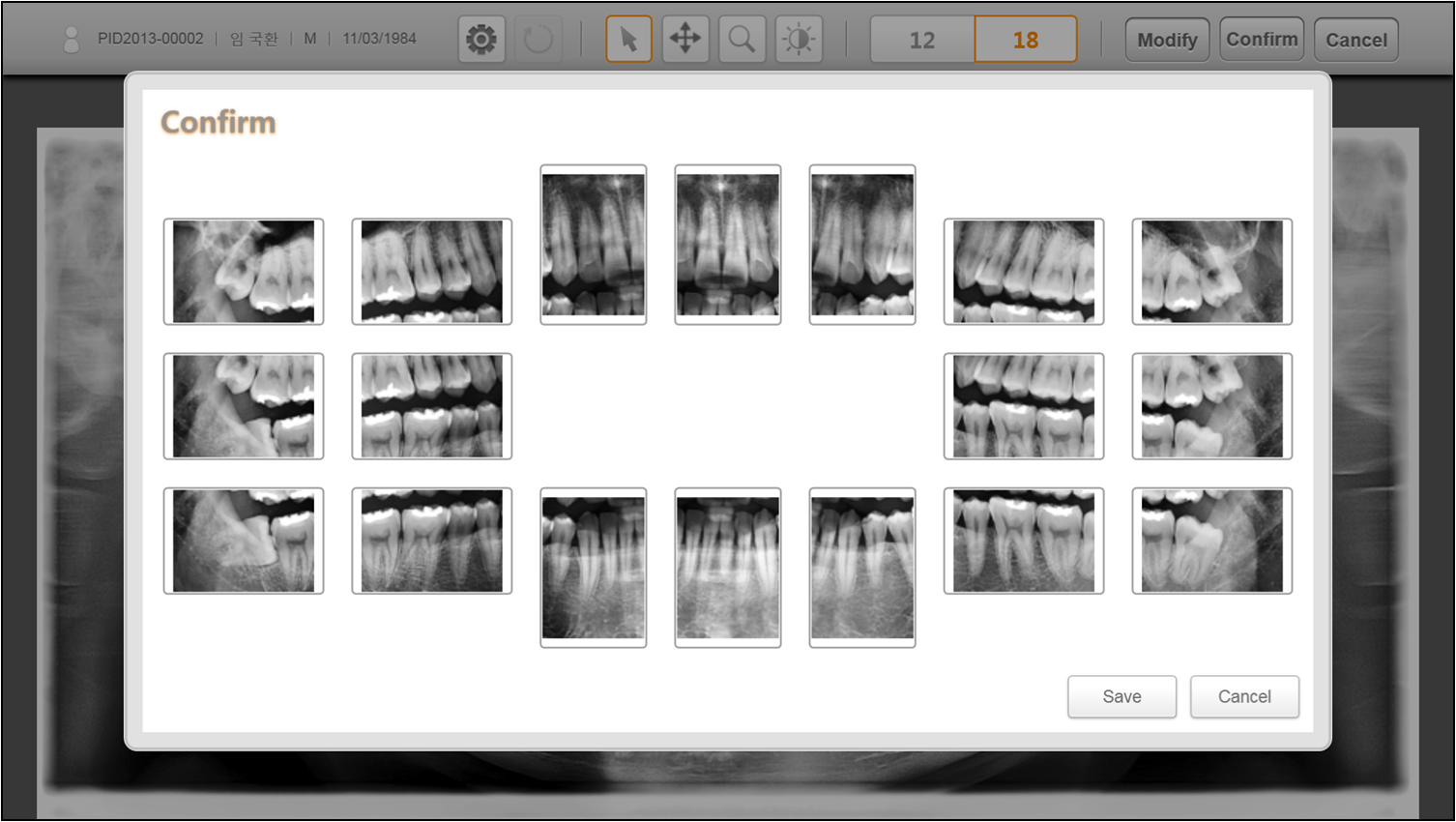 Rayscan Expert Features